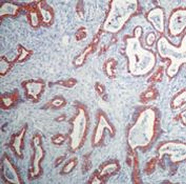 Cytokeratin 20 Antibody in Immunohistochemistry (Paraffin) (IHC (P))