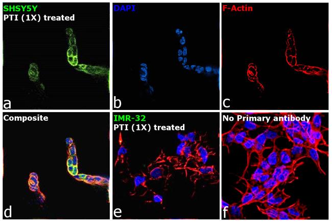 Chromogranin A Antibody in Immunocytochemistry (ICC/IF)