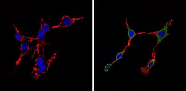 Cdk6 Antibody in Immunocytochemistry (ICC/IF)