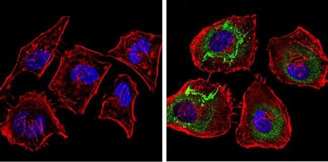 Thrombospondin 1 Antibody in Immunocytochemistry (ICC/IF)