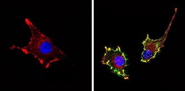 CD81 Antibody in Immunocytochemistry (ICC/IF)