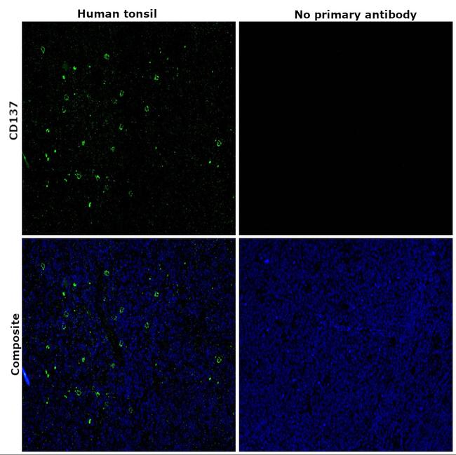 CD137 Antibody in Immunohistochemistry (Paraffin) (IHC (P))