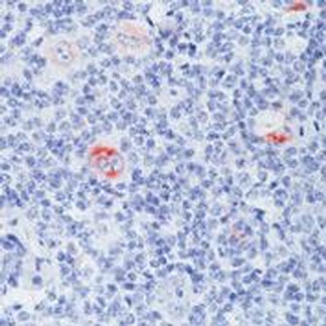 Bcl-X Antibody in Immunohistochemistry (Paraffin) (IHC (P))