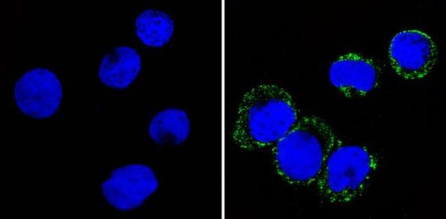 CD36 Antibody in Immunocytochemistry (ICC/IF)