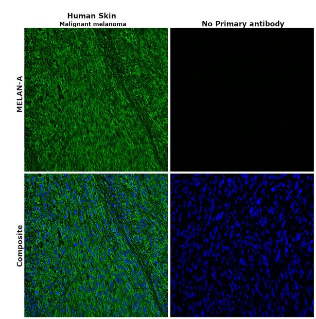 Melan-A Antibody in Immunohistochemistry (Paraffin) (IHC (P))