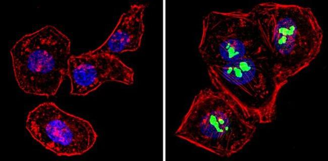 p14ARF Antibody in Immunocytochemistry (ICC/IF)