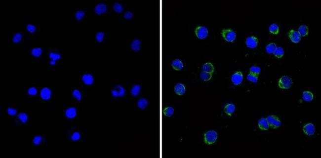 Cdk5 Antibody in Immunocytochemistry (ICC/IF)