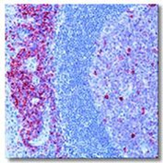 CD38 Antibody in Immunohistochemistry (Paraffin) (IHC (P))