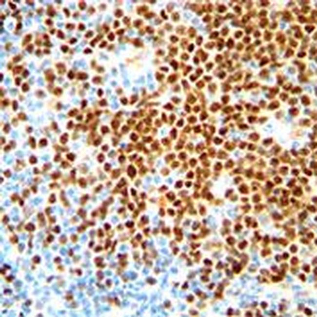 Cyclin D1 Antibody in Immunohistochemistry (Paraffin) (IHC (P))