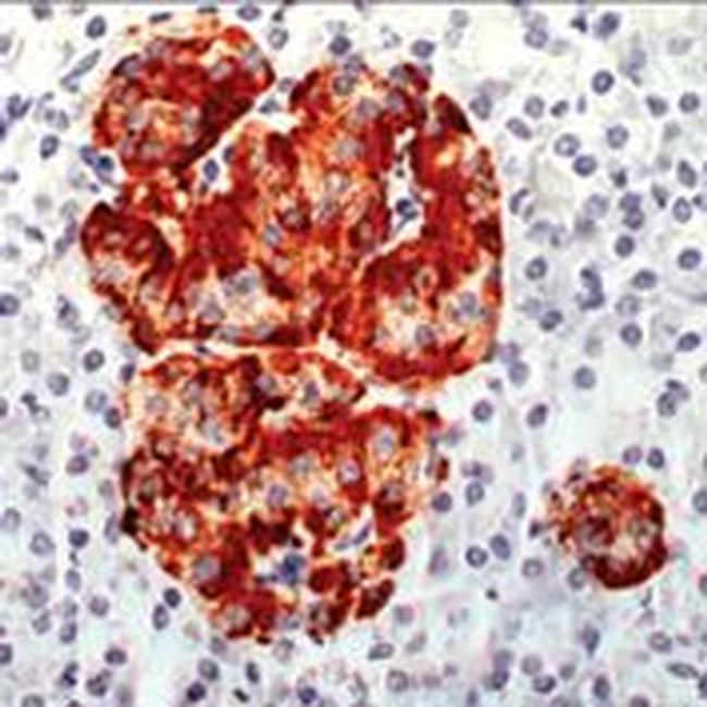 Chromogranin A Antibody in Immunohistochemistry (Paraffin) (IHC (P))