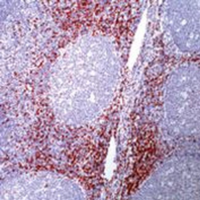 CD8 Antibody in Immunohistochemistry (Paraffin) (IHC (P))