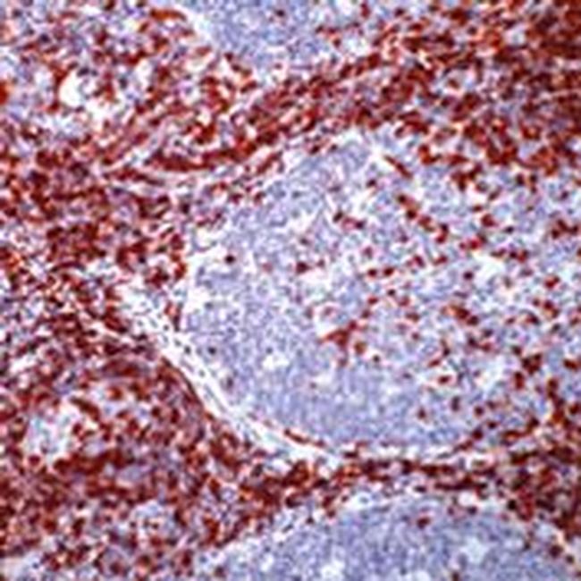 CD5 Antibody in Immunohistochemistry (Paraffin) (IHC (P))