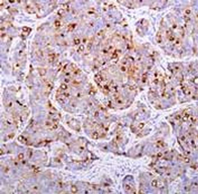 PSMA Antibody in Immunohistochemistry (Paraffin) (IHC (P))