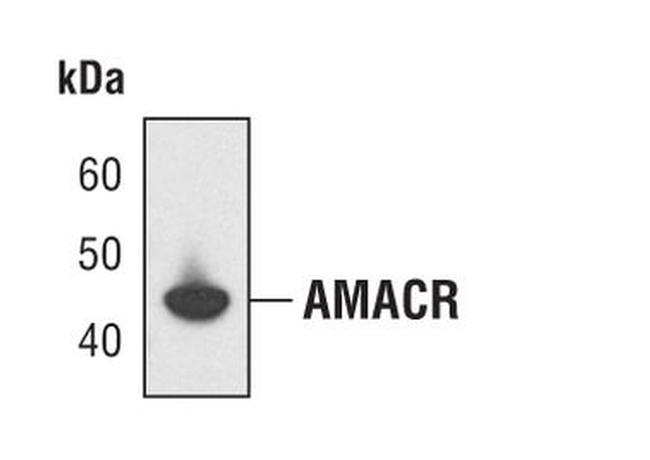 AMACR Antibody in Western Blot (WB)