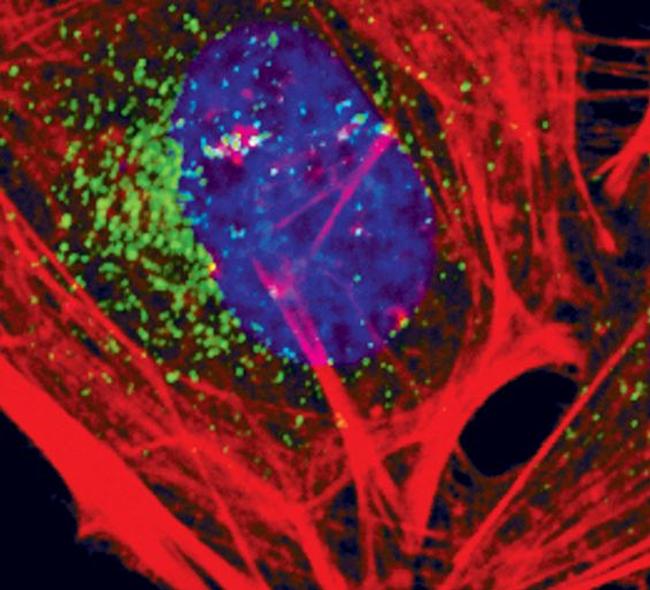 EEA1 Antibody in Immunocytochemistry (ICC/IF)