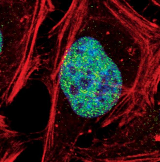 SETD8 Antibody in Immunocytochemistry (ICC/IF)