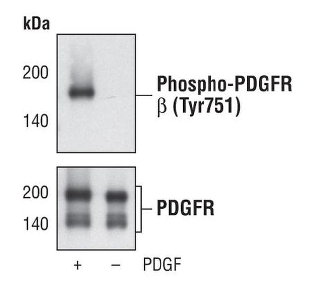 Phospho-PDGFRB (Tyr751) Antibody in Western Blot (WB)