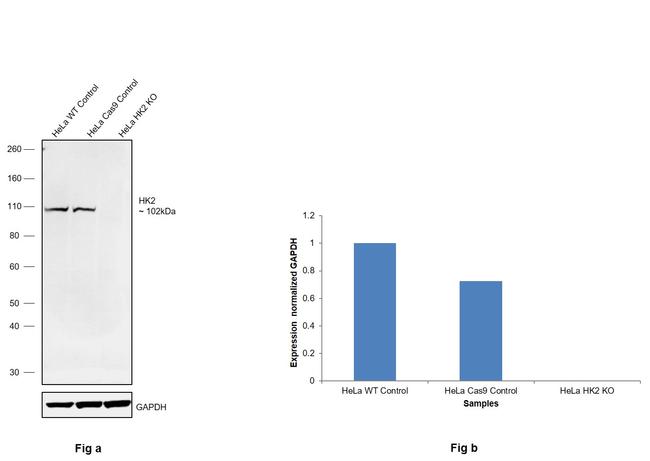 HK2 Antibody in Western Blot (WB)