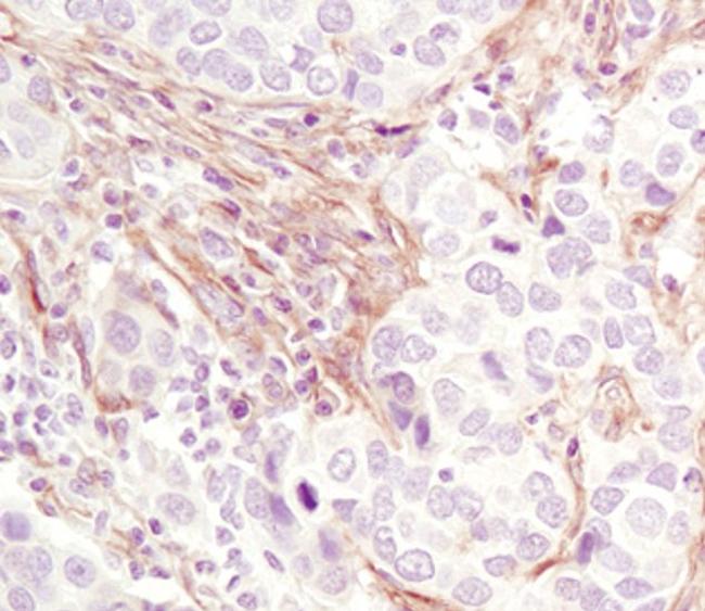 PDGFRB Antibody in Immunohistochemistry (Paraffin) (IHC (P))