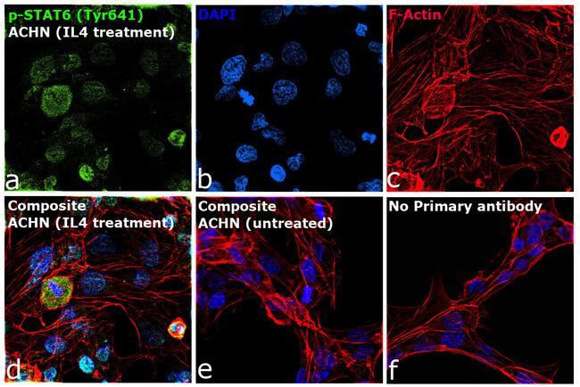 Phospho-STAT6 (Tyr641) Antibody in Immunocytochemistry (ICC/IF)
