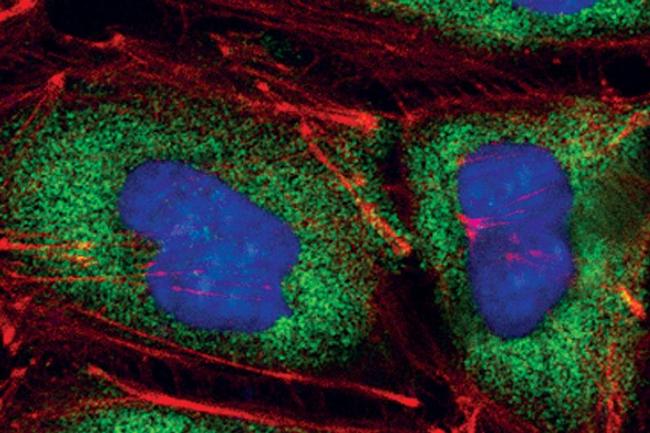 eIF4G Antibody in Immunocytochemistry (ICC/IF)