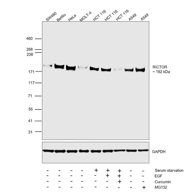 RICTOR Antibody in Western Blot (WB)