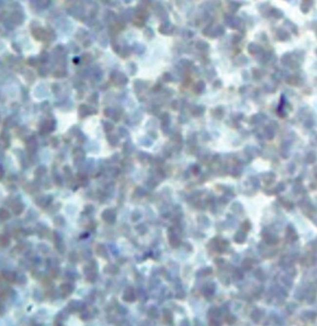 DRAK2 Antibody in Immunohistochemistry (Paraffin) (IHC (P))