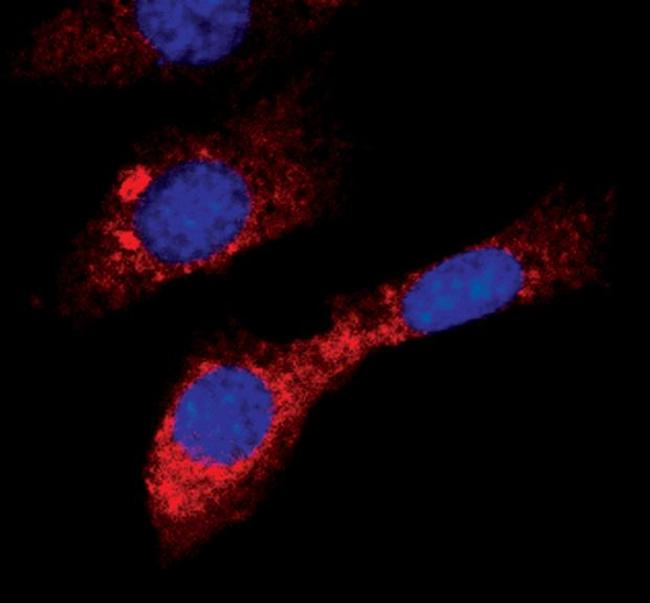 Acetyl-CoA Carboxylase Antibody in Immunocytochemistry (ICC/IF)