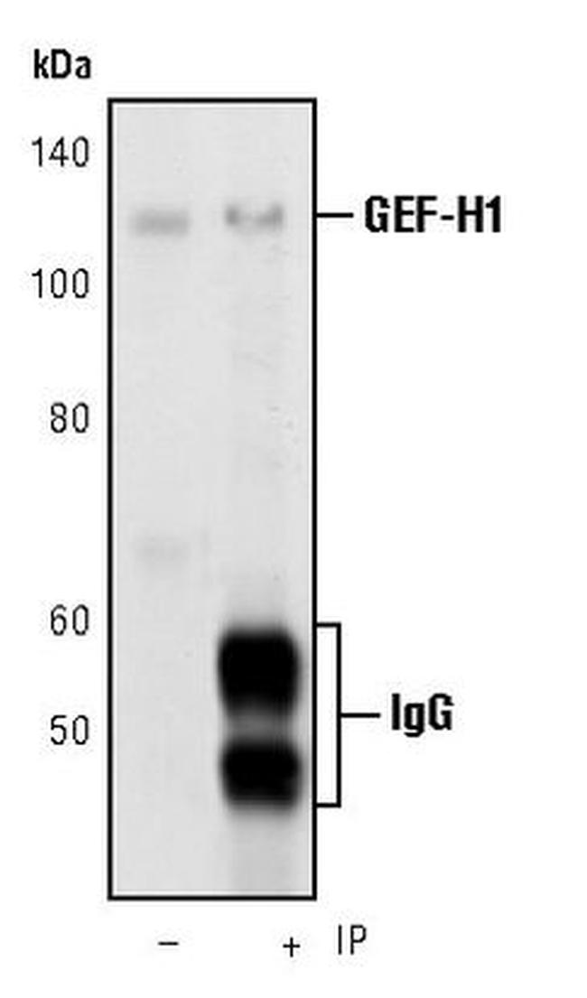 GEF-H1 Antibody in Immunoprecipitation (IP)