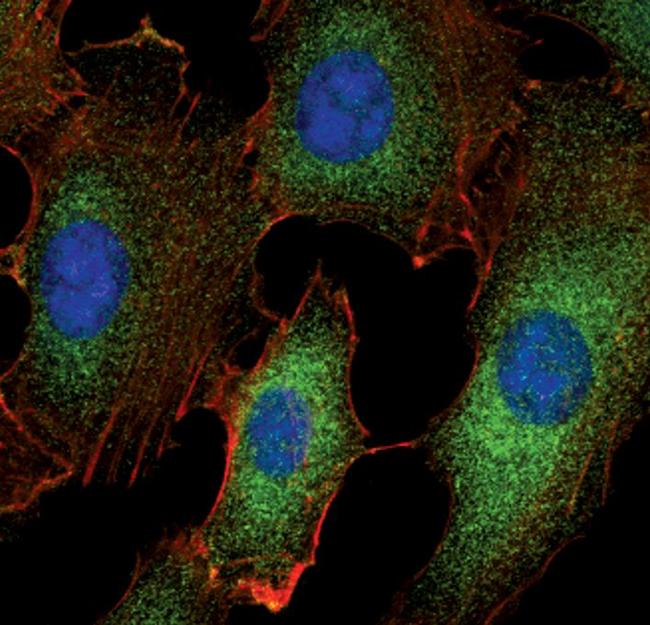 TRAF1 Antibody in Immunocytochemistry (ICC/IF)