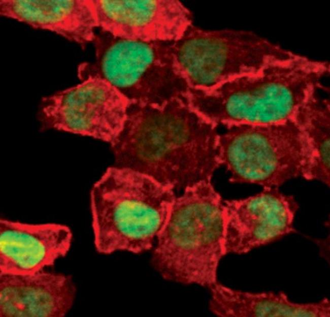 FosB Antibody in Immunocytochemistry (ICC/IF)