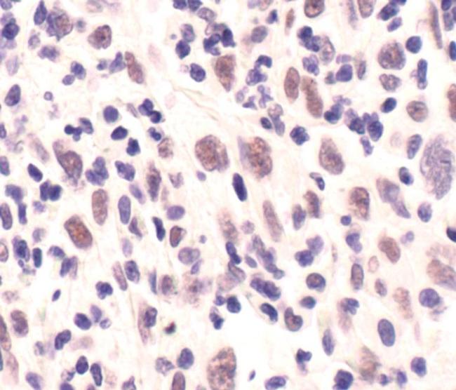 MRE11 Antibody in Immunohistochemistry (Paraffin) (IHC (P))