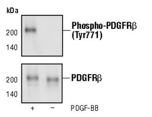 Phospho-PDGFRB (Tyr771) Antibody in Western Blot (WB)