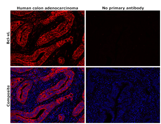 Bcl-xL Antibody in Immunohistochemistry (Paraffin) (IHC (P))