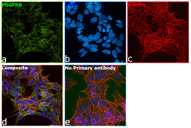 PDGFRB Antibody in Immunocytochemistry (ICC/IF)