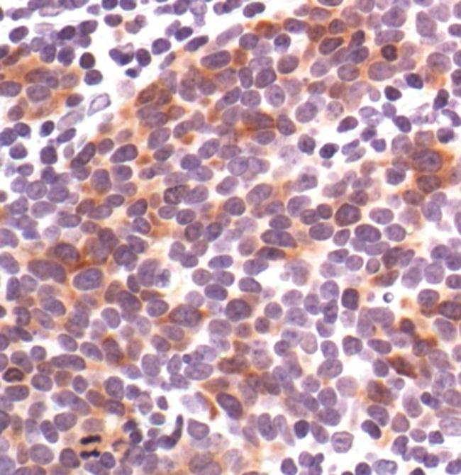 Phospho-Cdc25C (Ser216) Antibody in Immunohistochemistry (Paraffin) (IHC (P))