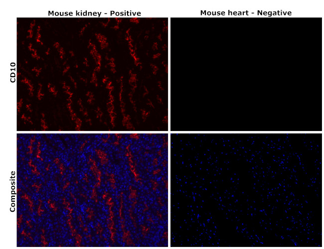 CD10 Antibody in Immunohistochemistry (Paraffin) (IHC (P))