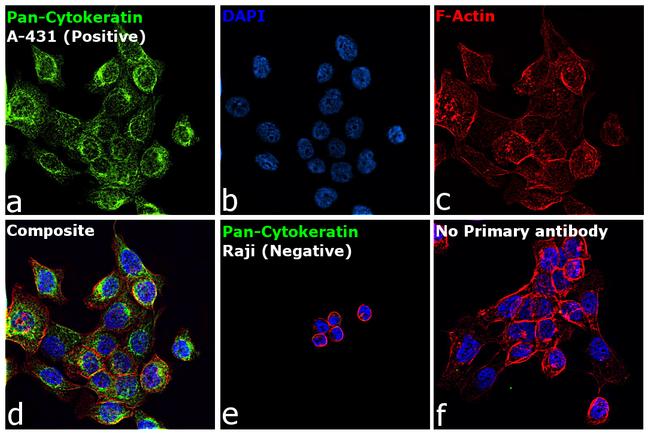 Cytokeratin Pan Antibody in Immunocytochemistry (ICC/IF)