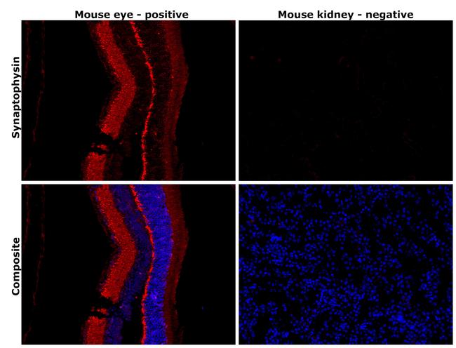 Synaptophysin Antibody in Immunohistochemistry (Paraffin) (IHC (P))