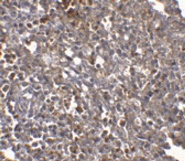 ORAI1 Antibody in Immunohistochemistry (IHC)