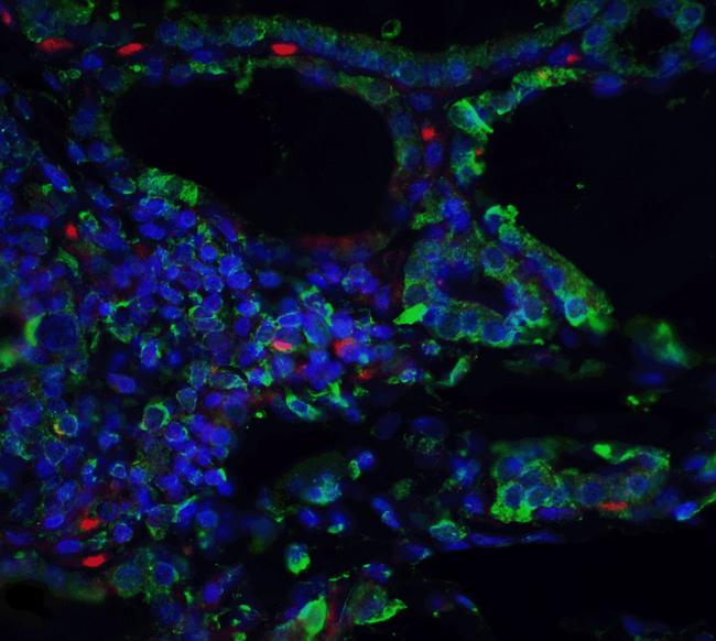 ORAI3 Antibody in Immunohistochemistry (IHC)