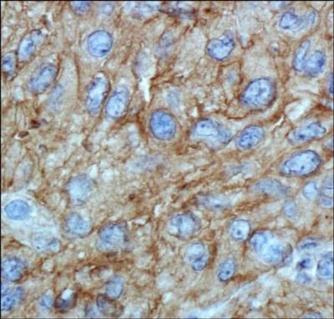 ABCA1 Antibody in Immunohistochemistry (Paraffin) (IHC (P))