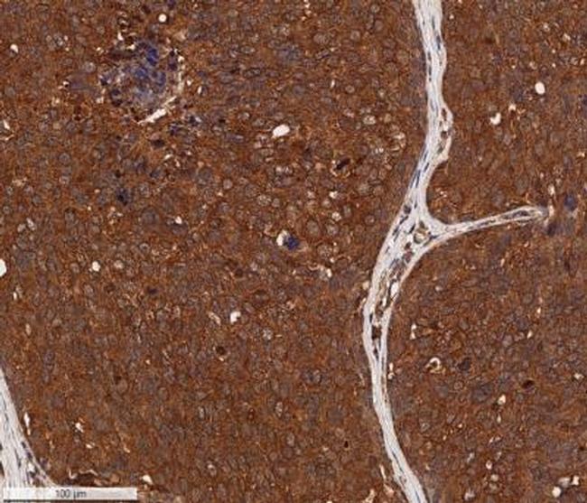 Cytokeratin 1 Antibody in Immunohistochemistry (Paraffin) (IHC (P))