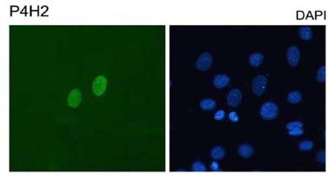 DUX4 Antibody in Immunocytochemistry (ICC/IF)