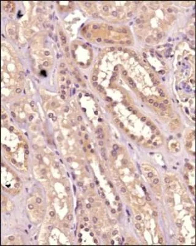 IKK alpha Antibody in Immunohistochemistry (Paraffin) (IHC (P))