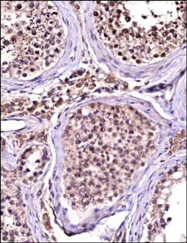 TBK1 Antibody in Immunohistochemistry (Paraffin) (IHC (P))