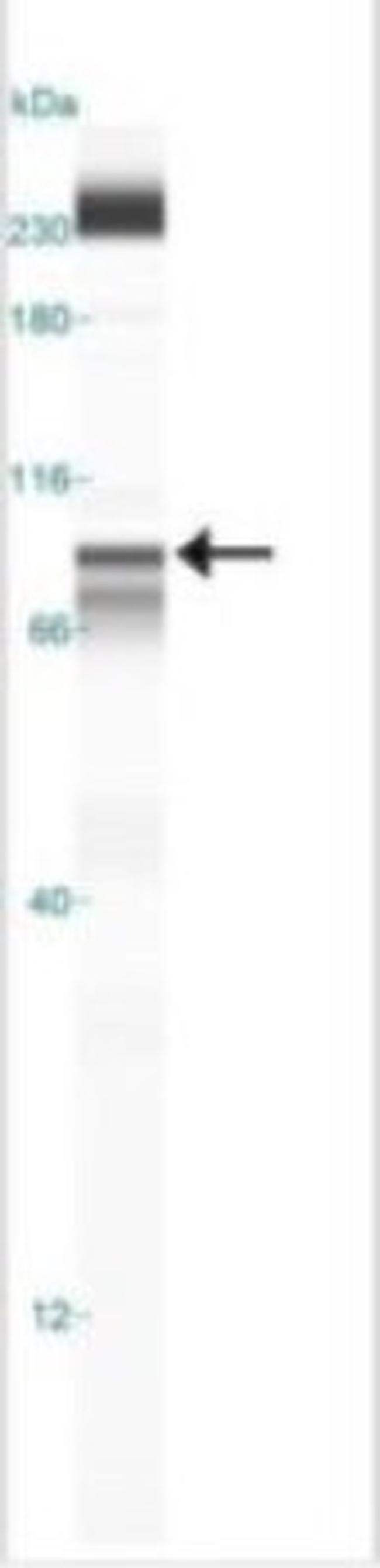 IKK beta Antibody in Western Blot (WB)