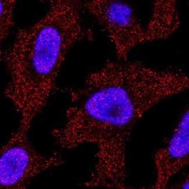 p73 Antibody in Immunocytochemistry (ICC/IF)