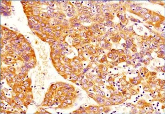 DNMT3A Antibody in Immunohistochemistry (Paraffin) (IHC (P))