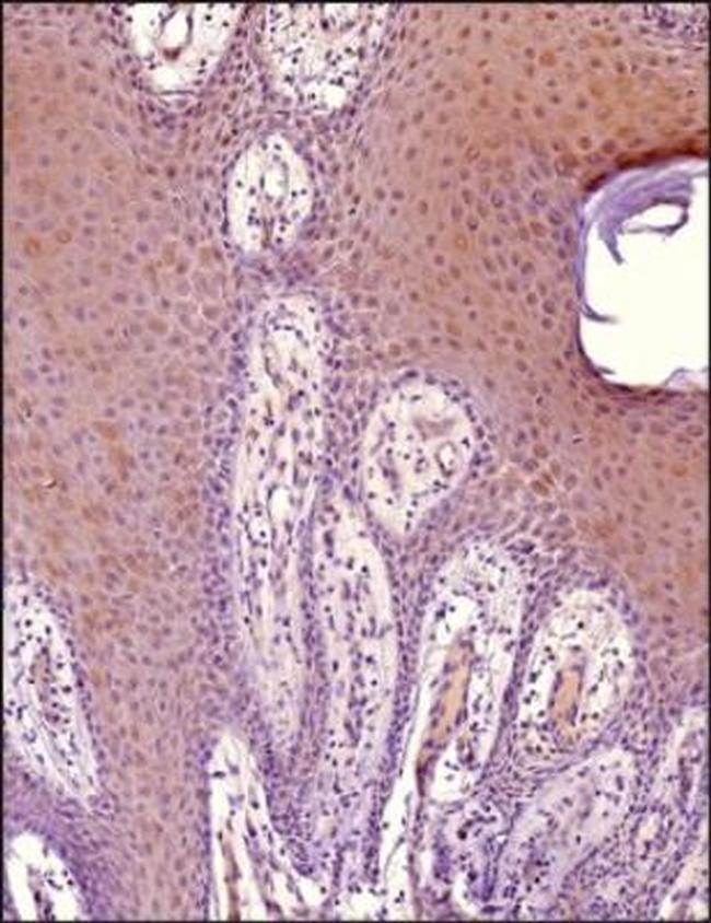 MiTF Antibody in Immunohistochemistry (Paraffin) (IHC (P))